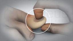 Circulation Checks: Lower Extremity