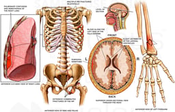 Injuries to the Head, Chest and Wrist