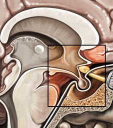 Enlarged Brain, Sagittal View