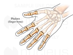Finger Phalanx