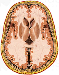 Brain within Skull, Superior Cut-away View