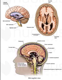 Normal Anatomy Frontal