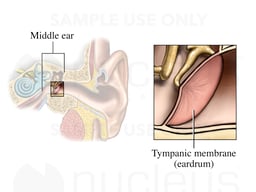 The Eardrum