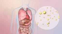 ¿Qué es el alto contenido de potasio (hipercalemia)?
