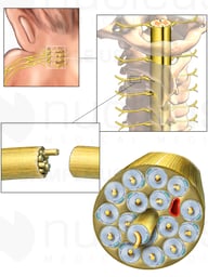 Anatomy of a Spinal Nerve in the Brachial Plexus