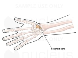 The Scaphoid Bone