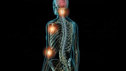 Conditions Resulting in Back Pain