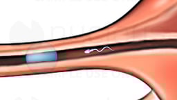 Mechanism of Conception - Medical Animation