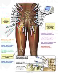 Summary of Injections and Surgeries