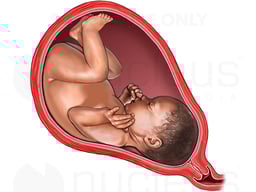 Fetus in Utero, Third Trimester, Lateral View