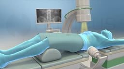 Extracorporeal Shock Wave Lithotripsy (ESWL)