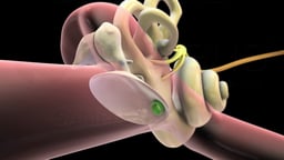 Middle Ear with Tympanostomy Tube