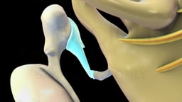 Close-Up of Middle Ear Ossicles