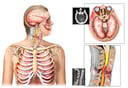 Female Torso with Injuries of the Head, Brain, Neck and Chest
