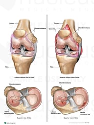 Progression of Right Knee Condition