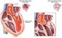 Aortic Valve Function