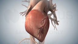 Acute Coronary Syndrome and Heart Attack