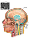 Brainstem Tumor with Obstruction of Cerebrospinal Fluid (CSF) Flow through the 4th Ventricle
