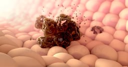 What is Targeted Therapy for Breast Cancer? 