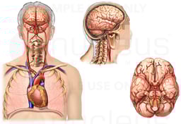 Arteries of the Brain