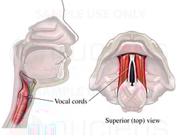 Vocal Cords