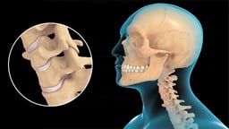 Anatomy of the Cervical Spine