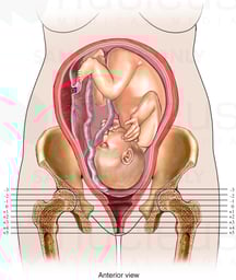 Stations of Presentation - Fetal Head Positions During Descent