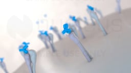 Targeted Cancer Cell Therapy