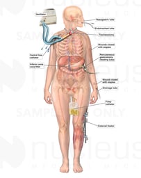 Medical and Surgical Procedures