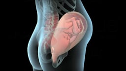 Mucus Plug/ Water Breaking