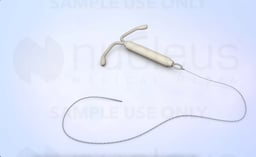 How Effective is an IUD? 