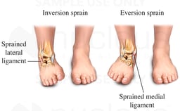 Ankle Inversion and Eversion