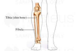 Bones of the Lower Leg