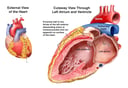 External View of the Heart- Coronary Arteries