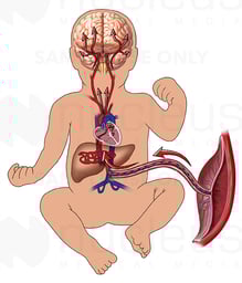 Fetal Circulation