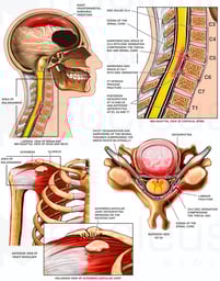 Brain, Cervical Spine, Spinal Cord and Shoulder Injuries