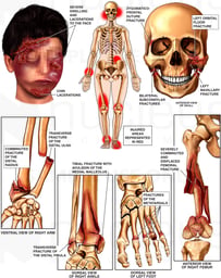 Injuries to the Face, Skull, Forearm, Thigh, Ankle and Foot