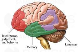 Areas of the Brain Affected by Alzheimer's Disease