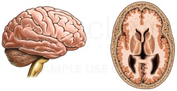 Anatomy of the Brain