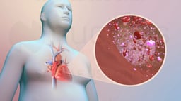 Diabetes and Your Risk of Heart Disease