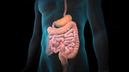 Colon Resection