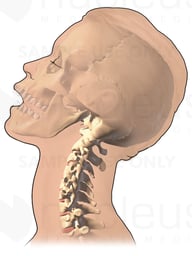 Neck Extension