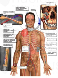 Multiple Surgical Repairs