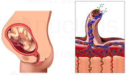 Normal Anatomy of the Placenta