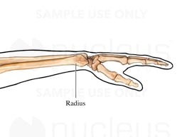 Wrist Lateral View