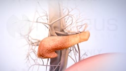 Gestational Diabetes