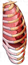 Pneumothorax and Rib Fractures, Anterior View
