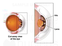 The Iris and Lens
