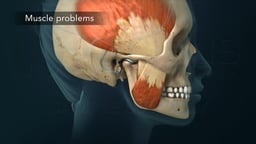TMJ Disorders: Muscle Problems