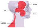 TMJ: Areas of Pain
